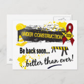 建築多発性骨髄腫 ポストカード (正面/裏面)