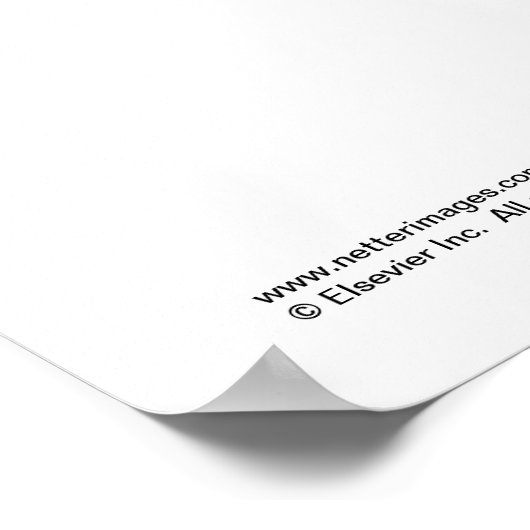 後腹壁 ポスター (角)