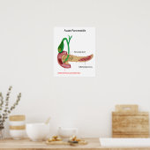 急性膵炎ポスター ポスター (キッチン)