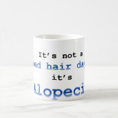 悪い髪の日ではない…脱毛症だ コーヒーマグカップ (中央)