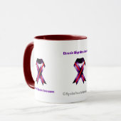 慢性の片頭痛の認識度 マグカップ (正面左)