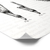 手と手首の古い解剖学芸術の筋肉 ポスター (角)