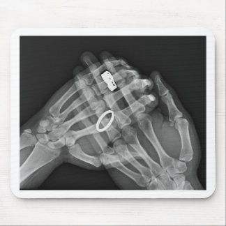 手の保有物 マウスパッド