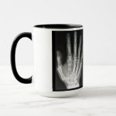 手のX線の女王 マグカップ (左)