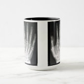 手のX線の女王 マグカップ (中央)