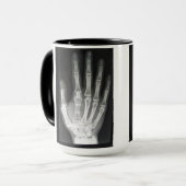 手のX線の女王 マグカップ (正面左)