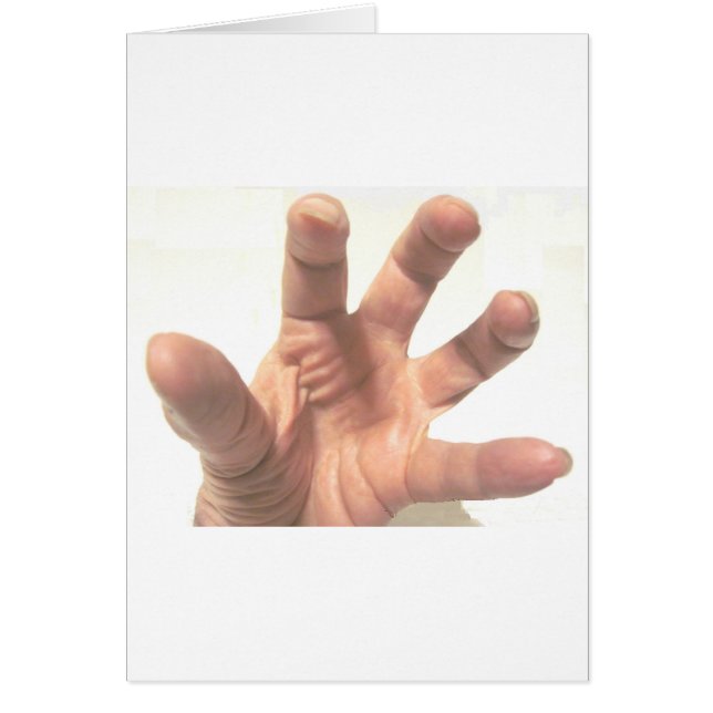 手を掴む (正面)