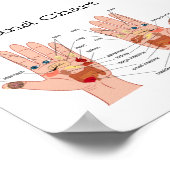 手リフレクソロジー6x6インチ ポスター (角)