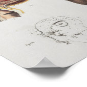 手術医療技術ヴィンテージ解剖学プリント ポスター (角)