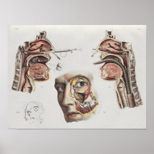 手術医療技術ヴィンテージ解剖学プリント ポスター (正面)