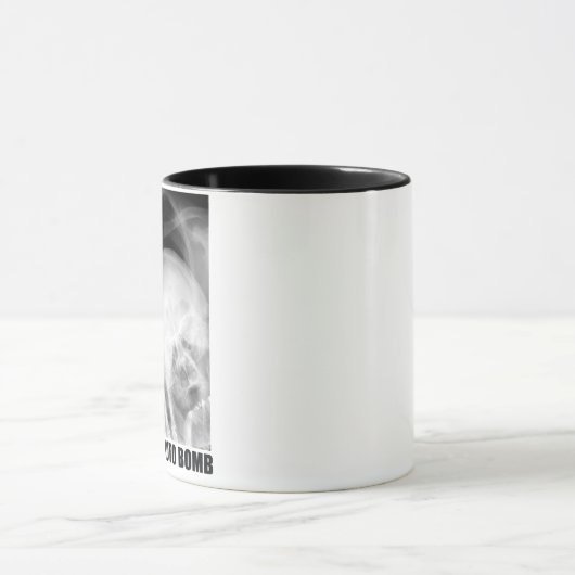 放射線科医による写真爆弾 マグカップ (中央)