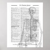 整形外科Dr.外科医の放射線医の退職ギフト ポスター (正面)