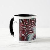 新しい! カスタマイズ可能な"悪性のStruma Ovarii " マグカップ (正面左)