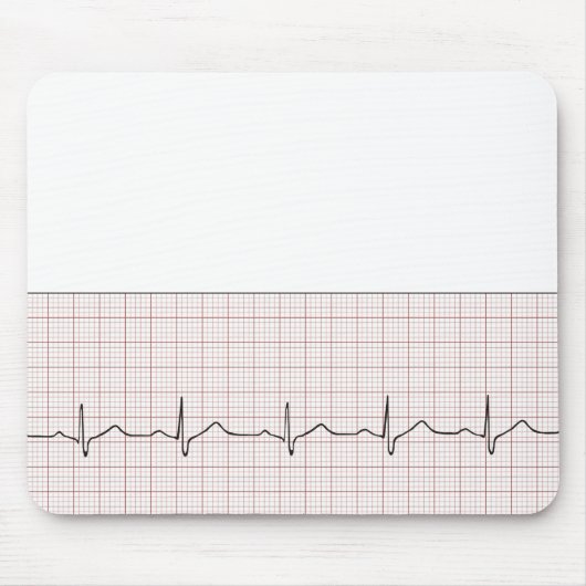 方眼紙のEKGの心拍、PhD (医者)の脈拍 マウスパッド (正面)