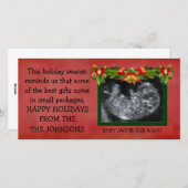 最も最高のなクリスマスのギフトの超音波の写真 シーズンカード (正面/裏面)