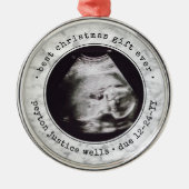 最高のGift Ever超音波ベビー写真フェイク大理石 メタルオーナメント (正面)