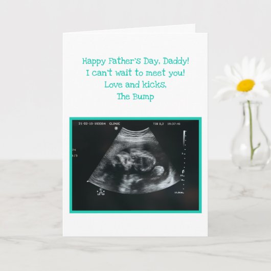 未生ベビーパパ父の日を期待 カード (小さな植物)