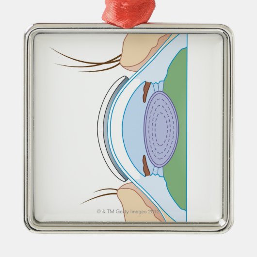 柔らかいコンタクトレンズ メタルオーナメント (正面)