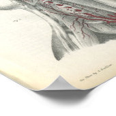 椎体動脈頸部解剖学プリント ポスター (角)