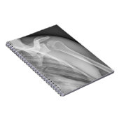 標準肩。健康X線離れ ノートブック (右側)