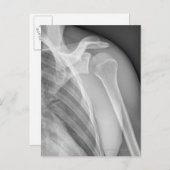 標準肩。健康X線離れ ポストカード (正面/裏面)