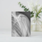 標準肩。健康X線離れ ポストカード (スタンド正面)