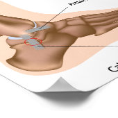 横足首捻挫グレーディングポスター ポスター (角)