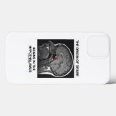 欲望の起源は視床下部から始まる Case-Mate iPhoneケース (裏面 (横))
