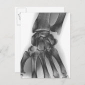 正常な手首、X線 ポストカード (正面/裏面)