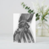 正常な手首、X線 ポストカード (スタンド正面)