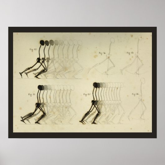 歩く足並み解析脚の背骨カイロプラクティックグラフ ポスター (正面)