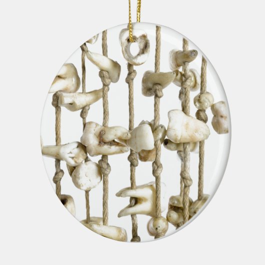 歯おもしろい歯歯科医院 セラミックオーナメント (左)