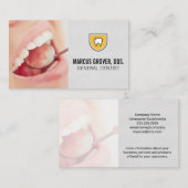 歯の口元検査 名刺 (正面/裏面)