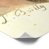 歯の抽出1790 ポスター (角)