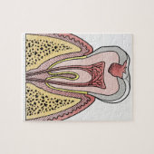 歯の減衰を示す断面イラストレーション ジグソーパズル (横)