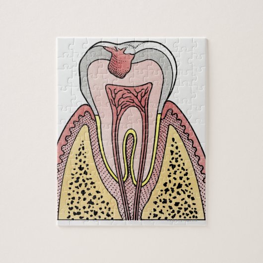 歯の減衰を示す断面イラストレーション ジグソーパズル (縦)