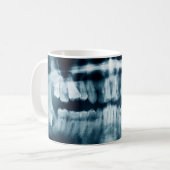 歯のX線 コーヒーマグカップ (正面左)
