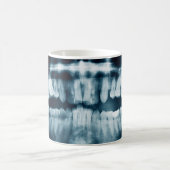 歯のX線 コーヒーマグカップ (中央)