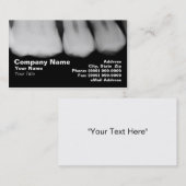 歯のX線 名刺 (正面/裏面)