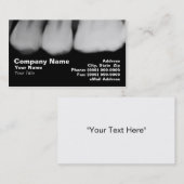 歯のX線 名刺 (正面/裏面)