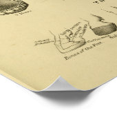 歯グラフの馬の年齢チャート歯科解剖学ポスター ポスター (角)