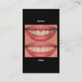 歯周モダン歯科ビジネスカード 名刺 (裏面)