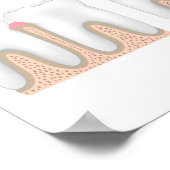 歯周病ポスター ポスター (角)