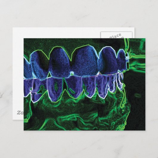 歯型熱狂する歯科医歯科矯正医カード ポストカード (正面/裏面)