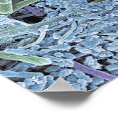 歯垢、色付き走査電子 ポスター (角)