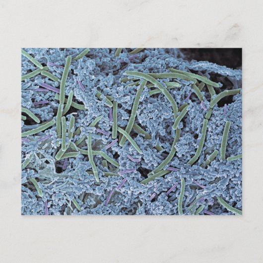 歯垢、色付き走査電子 ポストカード (正面)