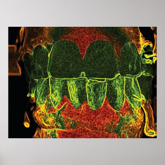歯熱狂する噛み歯科歯科矯正医ポスター ポスター (正面)