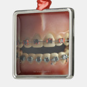 歯科モデルおよび歯の支柱 メタルオーナメント (左)