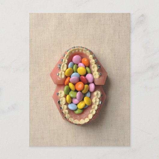 歯科モデルで提供されたチョコレート ポストカード (正面)