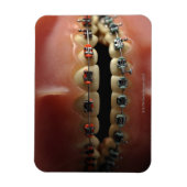 歯科モデルと歯のブレース マグネット (縦)